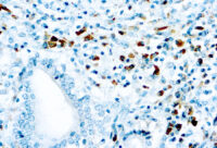 Immunohistochemical staining of Kappa Light Chain  of human FFPE tissue followed by incubation with HRP labeled secondary and development with DAB substrate.