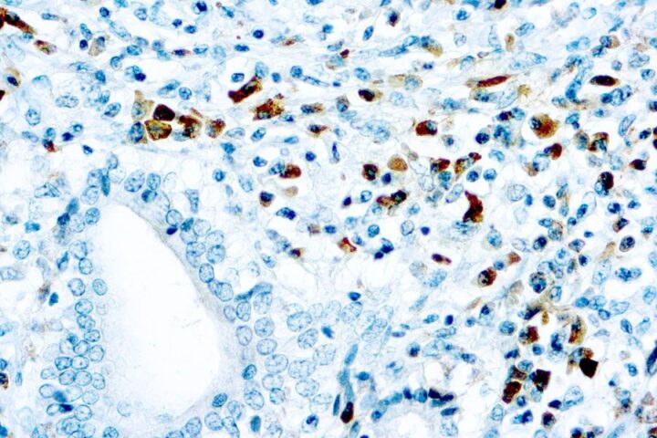 Immunohistochemical staining of Kappa Light Chain  of human FFPE tissue followed by incubation with HRP labeled secondary and development with DAB substrate.