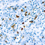 Immunohistochemical staining of Lambda Light Chain  of human FFPE tissue followed by incubation with HRP labeled secondary and development with DAB substrate.