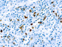 Immunohistochemical staining of Lambda Light Chain  of human FFPE tissue followed by incubation with HRP labeled secondary and development with DAB substrate.