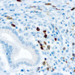 Immunohistochemical staining of Lambda Light Chain  of human FFPE tissue followed by incubation with HRP labeled secondary and development with DAB substrate.