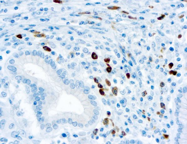 Immunohistochemical staining of Lambda Light Chain  of human FFPE tissue followed by incubation with HRP labeled secondary and development with DAB substrate.