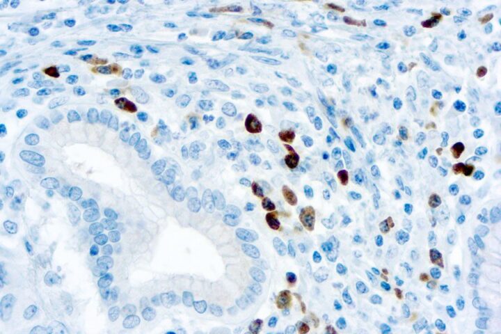Immunohistochemical staining of Lambda Light Chain  of human FFPE tissue followed by incubation with HRP labeled secondary and development with DAB substrate.