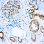 Immunohistochemical staining of Laminin  of human FFPE tissue followed by incubation with HRP labeled secondary and development with DAB substrate.