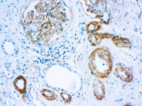 Immunohistochemical staining of Laminin  of human FFPE tissue followed by incubation with HRP labeled secondary and development with DAB substrate.