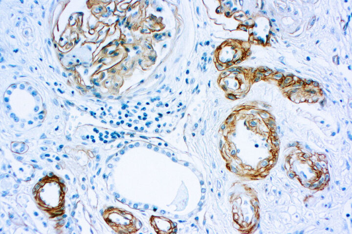 Immunohistochemical staining of Laminin  of human FFPE tissue followed by incubation with HRP labeled secondary and development with DAB substrate.