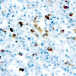 Immunohistochemical staining of Lambda Light Chain  of human FFPE tissue followed by incubation with HRP labeled secondary and development with DAB substrate.