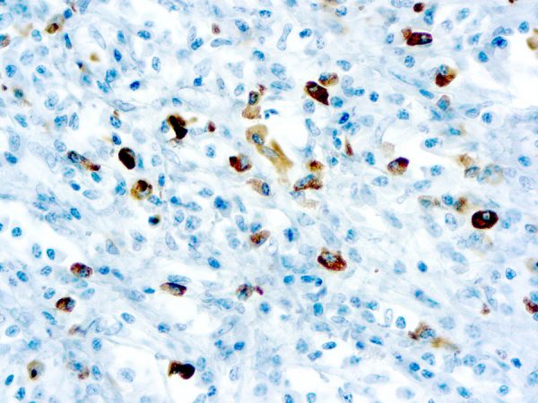 Immunohistochemical staining of Lambda Light Chain  of human FFPE tissue followed by incubation with HRP labeled secondary and development with DAB substrate.