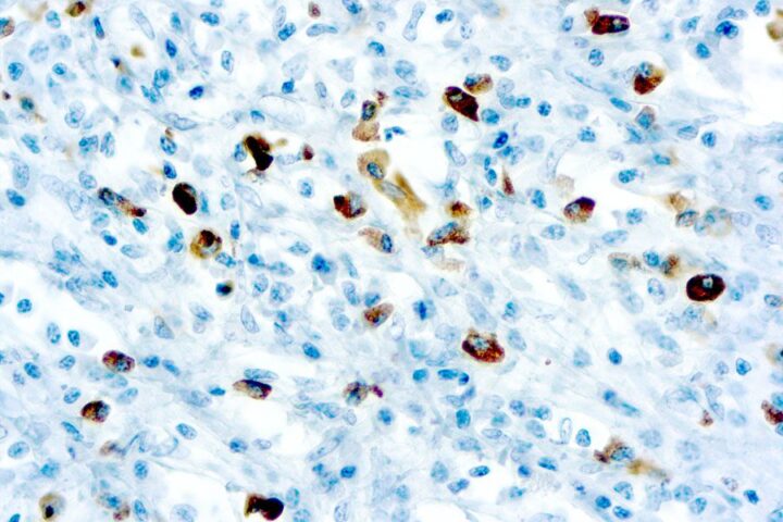 Immunohistochemical staining of Lambda Light Chain  of human FFPE tissue followed by incubation with HRP labeled secondary and development with DAB substrate.