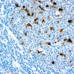 Immunohistochemical staining of Lysozyme/Muramidase  of human FFPE tissue followed by incubation with HRP labeled secondary and development with DAB substrate.