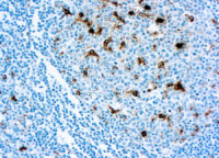 Immunohistochemical staining of Lysozyme/Muramidase  of human FFPE tissue followed by incubation with HRP labeled secondary and development with DAB substrate.