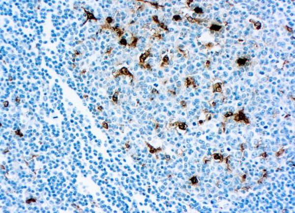 Immunohistochemical staining of Lysozyme/Muramidase  of human FFPE tissue followed by incubation with HRP labeled secondary and development with DAB substrate.