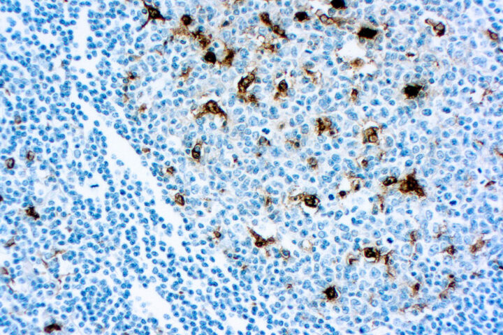 Immunohistochemical staining of Lysozyme/Muramidase  of human FFPE tissue followed by incubation with HRP labeled secondary and development with DAB substrate.