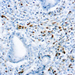 Immunohistochemical staining of Kappa Light Chain  of human FFPE tissue followed by incubation with HRP labeled secondary and development with DAB substrate.