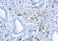 Immunohistochemical staining of Kappa Light Chain  of human FFPE tissue followed by incubation with HRP labeled secondary and development with DAB substrate.