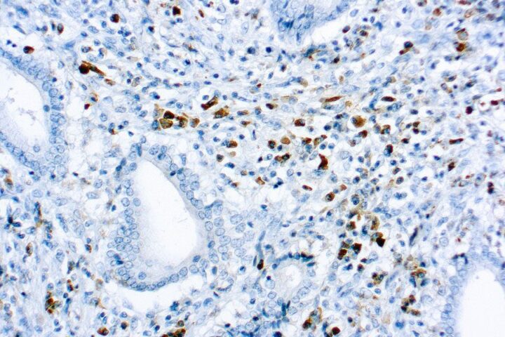 Immunohistochemical staining of Kappa Light Chain  of human FFPE tissue followed by incubation with HRP labeled secondary and development with DAB substrate.