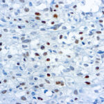 Immunohistochemical staining of Myogenin  of human FFPE tissue followed by incubation with HRP labeled secondary and development with DAB substrate.