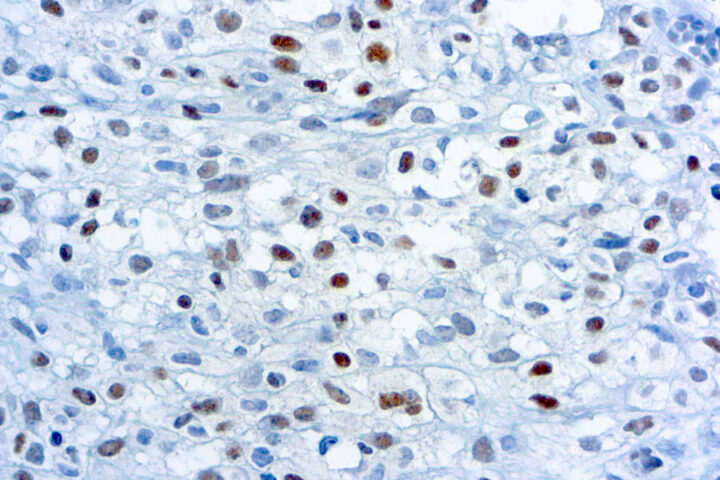 Immunohistochemical staining of Myogenin  of human FFPE tissue followed by incubation with HRP labeled secondary and development with DAB substrate.