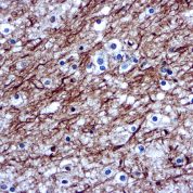 Immunohistochemical staining of Neurofilament  of human FFPE tissue followed by incubation with HRP labeled secondary and development with DAB substrate.