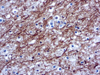 Immunohistochemical staining of Neurofilament  of human FFPE tissue followed by incubation with HRP labeled secondary and development with DAB substrate.