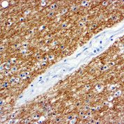 Immunohistochemical staining of Myelin Basic Protein  of human FFPE tissue followed by incubation with HRP labeled secondary and development with DAB substrate.