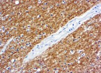 Immunohistochemical staining of Myelin Basic Protein  of human FFPE tissue followed by incubation with HRP labeled secondary and development with DAB substrate.