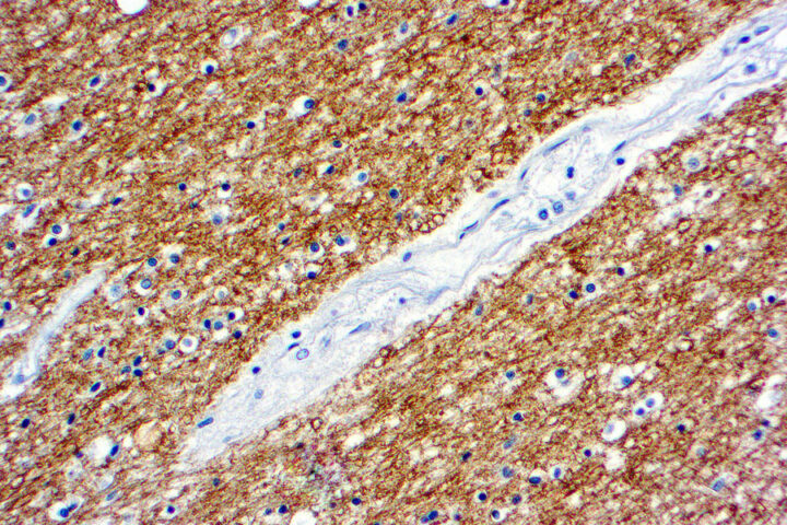 Immunohistochemical staining of Myelin Basic Protein  of human FFPE tissue followed by incubation with HRP labeled secondary and development with DAB substrate.