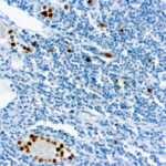 Immunohistochemical staining of Myeloperoxidase  of human FFPE tissue followed by incubation with HRP labeled secondary and development with DAB substrate.