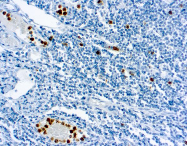 Immunohistochemical staining of Myeloperoxidase  of human FFPE tissue followed by incubation with HRP labeled secondary and development with DAB substrate.
