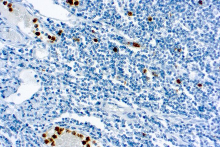 Immunohistochemical staining of Myeloperoxidase  of human FFPE tissue followed by incubation with HRP labeled secondary and development with DAB substrate.
