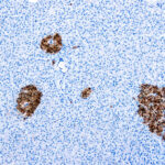 Immunohistochemical staining of Neuron Specific Enolase, Bovine  of human FFPE tissue followed by incubation with HRP labeled secondary and development with DAB substrate.