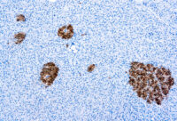 Immunohistochemical staining of Neuron Specific Enolase, Bovine  of human FFPE tissue followed by incubation with HRP labeled secondary and development with DAB substrate.