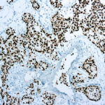 Immunohistochemical staining of 43742 of human FFPE tissue followed by incubation with HRP labeled secondary and development with DAB substrate.