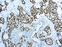 Immunohistochemical staining of 43742 of human FFPE tissue followed by incubation with HRP labeled secondary and development with DAB substrate.