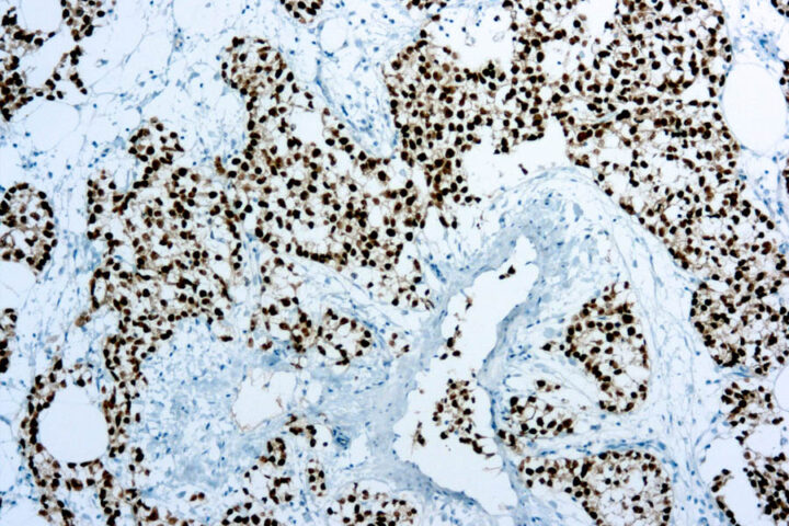 Immunohistochemical staining of 43742 of human FFPE tissue followed by incubation with HRP labeled secondary and development with DAB substrate.