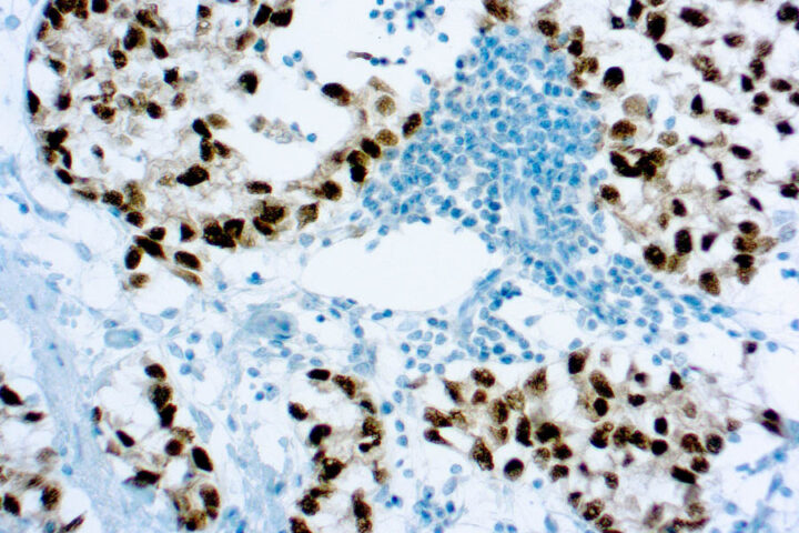 Immunohistochemical staining of 43742 of human FFPE tissue followed by incubation with HRP labeled secondary and development with DAB substrate.