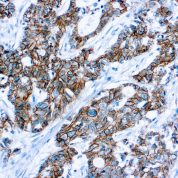 Immunohistochemical staining of p120 Catenin  of human FFPE tissue followed by incubation with HRP labeled secondary and development with DAB substrate.