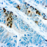 Immunohistochemical staining of p27Kip1  of human FFPE tissue followed by incubation with HRP labeled secondary and development with DAB substrate.