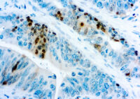 Immunohistochemical staining of p27Kip1  of human FFPE tissue followed by incubation with HRP labeled secondary and development with DAB substrate.