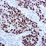 Immunohistochemical staining of p40  of human FFPE tissue followed by incubation with HRP labeled secondary and development with DAB substrate.