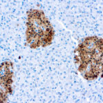 Immunohistochemical staining of Neuron Specific Enolase  of human FFPE tissue followed by incubation with HRP labeled secondary and development with DAB substrate.