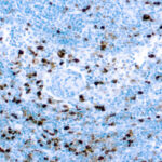 Immunohistochemical staining of Myeloperoxidase  of human FFPE tissue followed by incubation with HRP labeled secondary and development with DAB substrate.