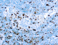 Immunohistochemical staining of Myeloperoxidase  of human FFPE tissue followed by incubation with HRP labeled secondary and development with DAB substrate.