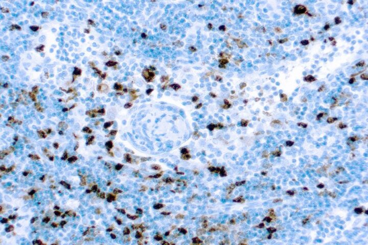 Immunohistochemical staining of Myeloperoxidase  of human FFPE tissue followed by incubation with HRP labeled secondary and development with DAB substrate.