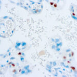 Immunohistochemical staining of p57Kip2  of human FFPE tissue followed by incubation with HRP labeled secondary and development with DAB substrate.