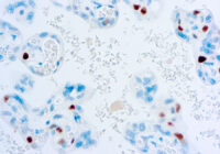 Immunohistochemical staining of p57Kip2  of human FFPE tissue followed by incubation with HRP labeled secondary and development with DAB substrate.