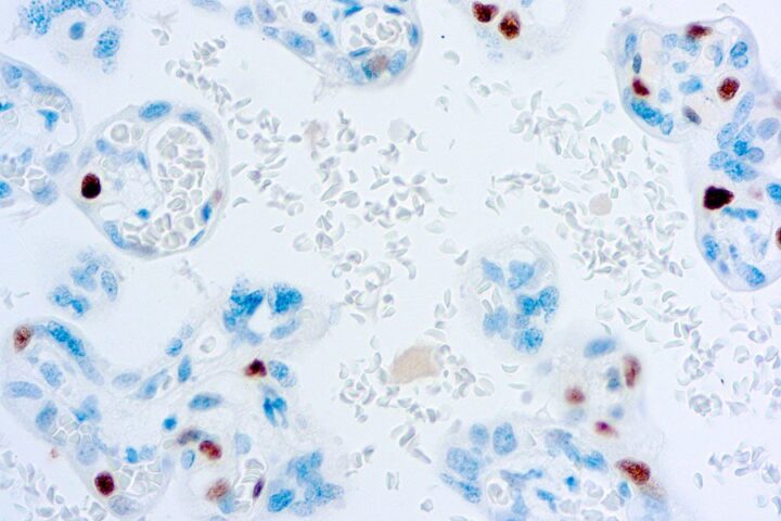 Immunohistochemical staining of p57Kip2  of human FFPE tissue followed by incubation with HRP labeled secondary and development with DAB substrate.
