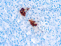 Immunohistochemical staining of Pancreatic Polypeptide  of human FFPE tissue followed by incubation with HRP labeled secondary and development with DAB substrate.