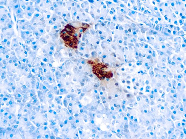 Immunohistochemical staining of Pancreatic Polypeptide  of human FFPE tissue followed by incubation with HRP labeled secondary and development with DAB substrate.