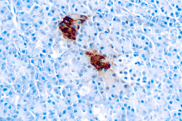 Immunohistochemical staining of Pancreatic Polypeptide  of human FFPE tissue followed by incubation with HRP labeled secondary and development with DAB substrate.